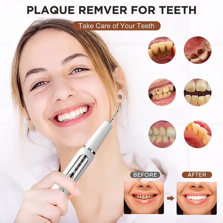 White Ultrasonic Dental Cleaner Home Use Plaque Remover Sonic Tooth Stain & Tartar Cleaning Tool