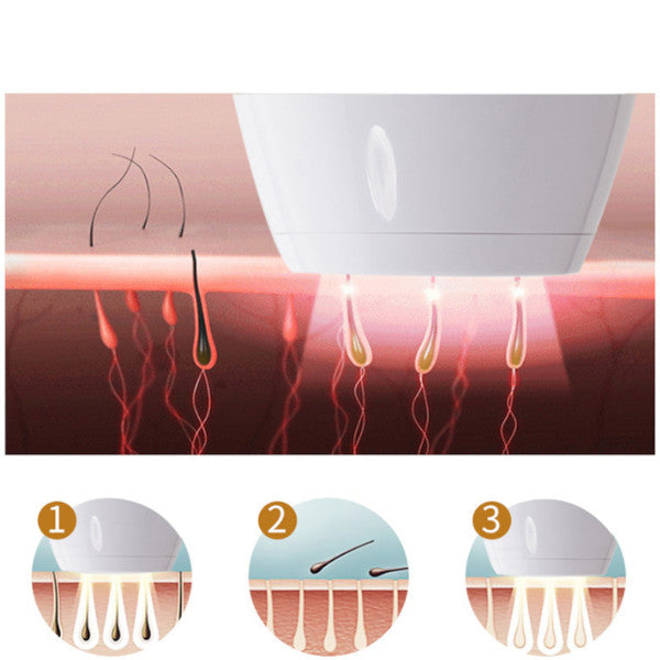 5 Level Laser Ipl Removal Machine Face Body Hair Shaving Epilator Kit