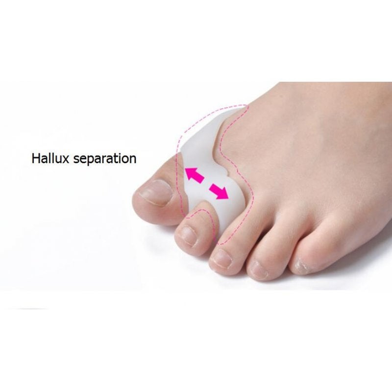 6 Pair Foot Care Tool Silicone Thumb Toe Dual Ring Separators Spacer Straightener