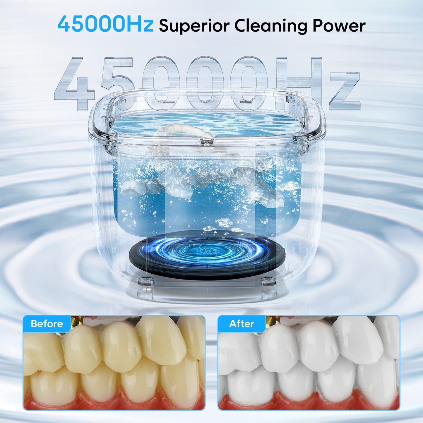 Professional Ultrasonic Cleaner With Uv Light - 45000Hz For Dentures Retainers Jewelry & More(White)