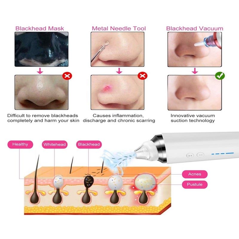 Blackhead Remover Vacuum Wifi 5.0Mp Visual Pore 20X Magnification Usb Rechargeable Electric Suction Facial Acne Extracto