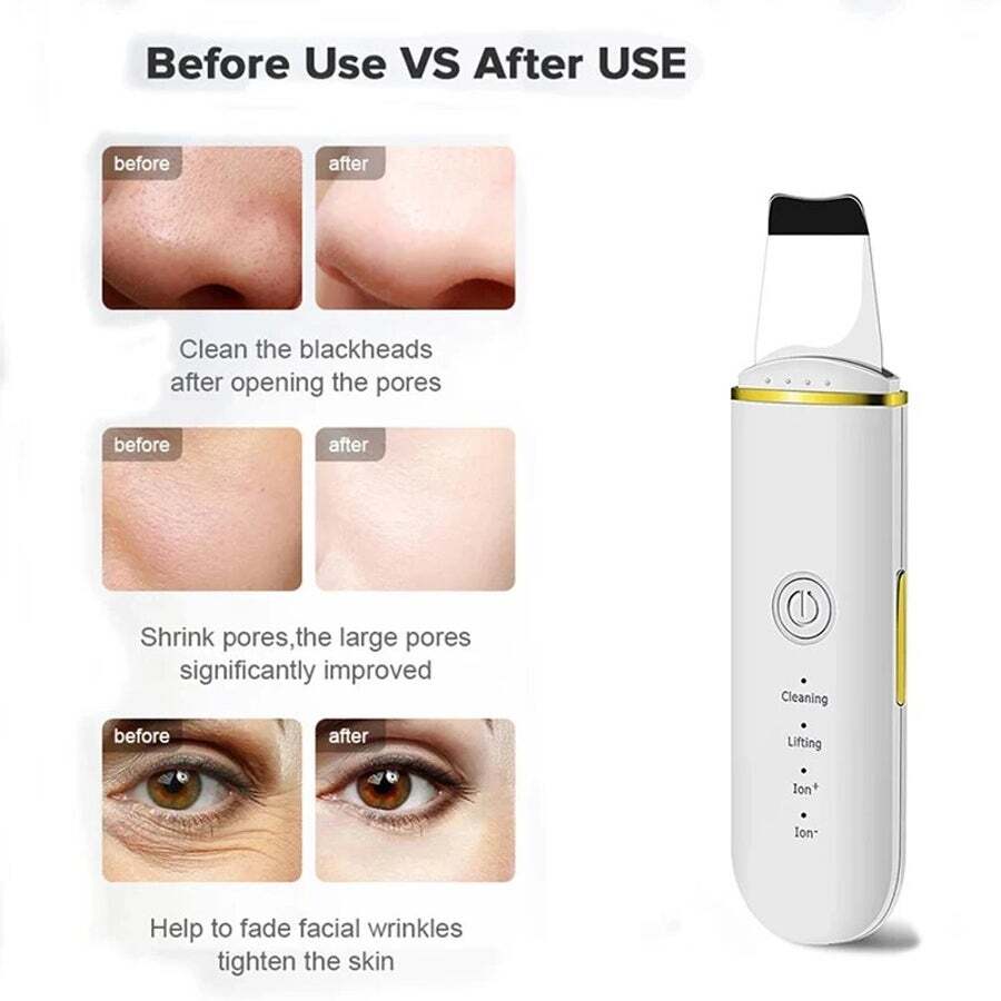 Ultrasonic Skin Scrubber Electric Vibration Deep Face Cleaning Peeling Shovel Facial Pore Cleaner Lifting Massager Beaut