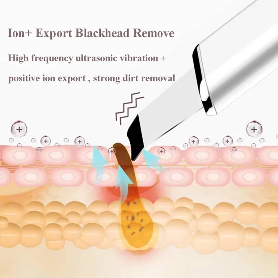 Ultrasonic Skin Scrubber Electric Vibration Deep Face Cleaning Peeling Shovel Facial Pore Cleaner Lifting Massager Beaut