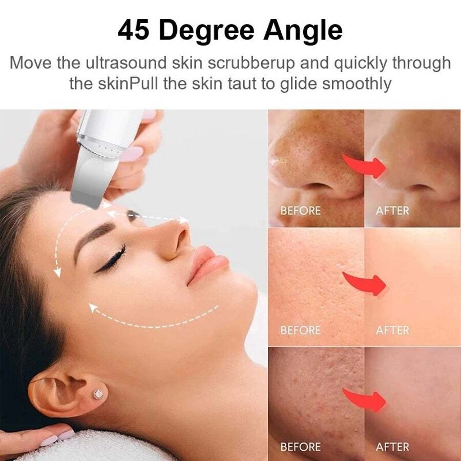 Ultrasonic Skin Scrubber Electric Vibration Deep Face Cleaning Peeling Shovel Facial Pore Cleaner Lifting Massager Beaut
