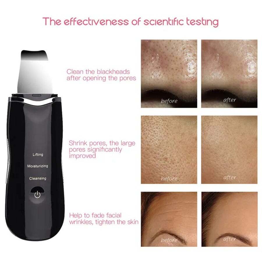 Ultrasonic Skin Scrubber Facial Cleaning Peeling Device