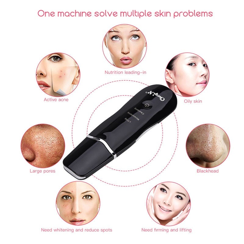 Ultrasonic Skin Scrubber Facial Cleaning Peeling Device